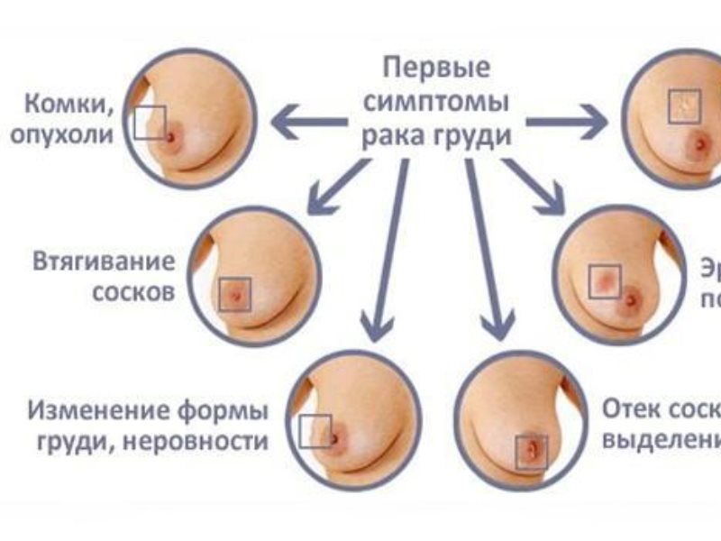 Грудь при беременности: как меняется, когда болит, по неделям — Медицинский женский центр в Москве